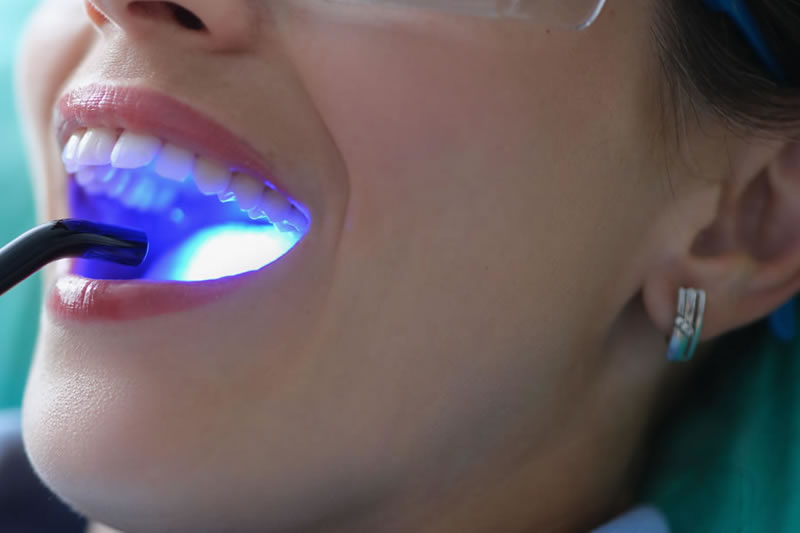 Laser Terapia  Fotobioestimulação